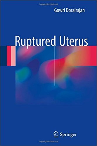 free-pdf-download-Ruptured Uterus 1st ed. 2017 Edition