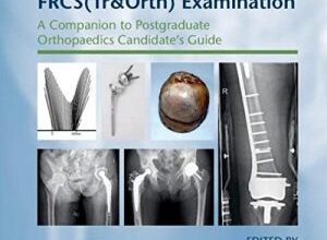 free-pdf-download-SBAs for the FRCS(Tr&Orth) Examination