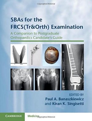 free-pdf-download-SBAs for the FRCS(Tr&Orth) Examination