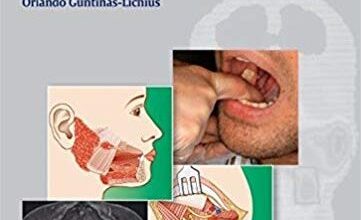 free-pdf-download-Salivary Gland Disorders and Diseases:: Diagnosis and Management 1st Edition