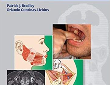 free-pdf-download-Salivary Gland Disorders and Diseases:: Diagnosis and Management 1st Edition