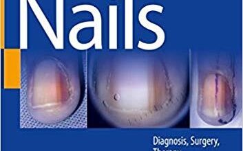 free-pdf-download-Scher and Daniel’s Nails: Diagnosis