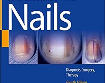 free-pdf-download-Scher and Daniel’s Nails: Diagnosis