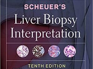 free-pdf-download-Scheuer’s Liver Biopsy Interpretation 10th Edition