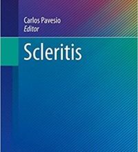 free-pdf-download-Scleritis (Essentials in Ophthalmology) 1st ed. 2017 Edition