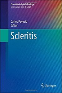 free-pdf-download-Scleritis (Essentials in Ophthalmology) 1st ed. 2017 Edition