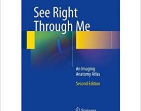 free-pdf-download-See Right Through Me