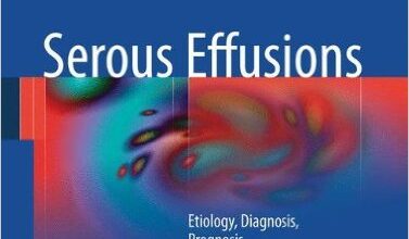 free-pdf-download-Serous Effusions: Etiology