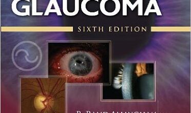 free-pdf-download-Shields Textbook of Glaucoma (Allingham