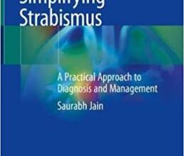 free-pdf-download-Simplifying Strabismus: A Practical Approach to Diagnosis and Management