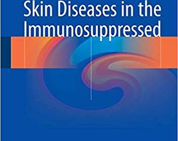 free-pdf-download-Skin Diseases in the Immunosuppressed 1st ed