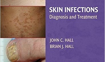 free-pdf-download-Skin Infections: Diagnosis and Treatment 1st Edition