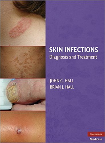 free-pdf-download-Skin Infections: Diagnosis and Treatment 1st Edition