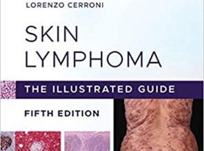 free-pdf-download-Skin Lymphoma: The Illustrated Guide 5th Edition