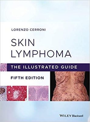 free-pdf-download-Skin Lymphoma: The Illustrated Guide 5th Edition