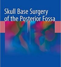 free-pdf-download-Skull Base Surgery of the Posterior Fossa 1st ed. 2018 Edition