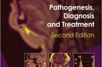 free-pdf-download-Sleep Apnea: Pathogenesis