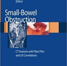 free-pdf-download-Small-Bowel Obstruction: CT Features with Plain Film and US correlations 2007th Edition