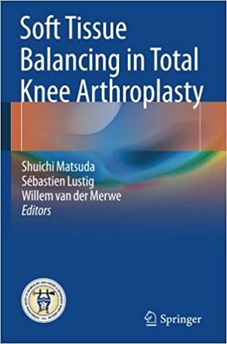 free-pdf-download-Soft Tissue Balancing in Total Knee Arthroplasty 1st ed. 2017 Edition