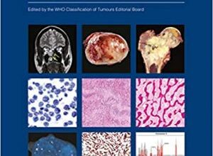 free-pdf-download-Soft Tissue and Bone Tumours: WHO Classification of Tumours 5th Edition