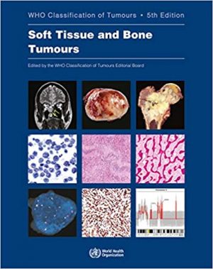 free-pdf-download-Soft Tissue and Bone Tumours: WHO Classification of Tumours 5th Edition