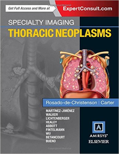 free-pdf-download-Specialty Imaging: Thoracic Neoplasms