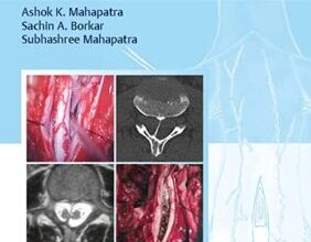 free-pdf-download-Split Cord Malformations