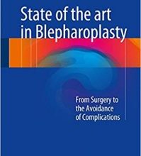 free-pdf-download-State of the art in Blepharoplasty: From Surgery to the Avoidance of Complications 1st ed