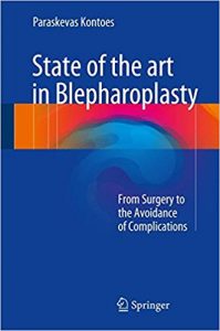 free-pdf-download-State of the art in Blepharoplasty: From Surgery to the Avoidance of Complications 1st ed