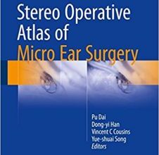 free-pdf-download-Stereo Operative Atlas of Micro Ear Surgery 1st ed. 2017 Edition