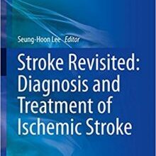 free-pdf-download-Stroke Revisited: Diagnosis and Treatment of Ischemic Stroke