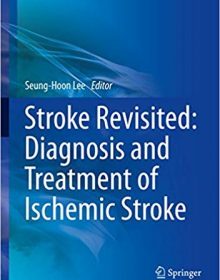 free-pdf-download-Stroke Revisited: Diagnosis and Treatment of Ischemic Stroke