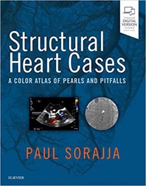 free-pdf-download-Structural Heart Cases: A Color Atlas of Pearls and Pitfalls