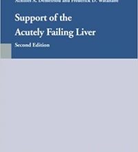 free-pdf-download-Support of the Acutely Failing Liver