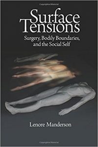 free-pdf-download-Surface Tensions: Surgery