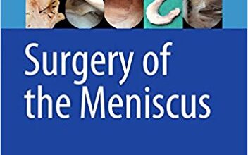 free-pdf-download-Surgery of the Meniscus 1st ed. 2016 Edition