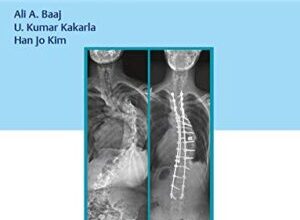 free-pdf-download-Surgery of the Thoracic Spine: Principles and Techniques