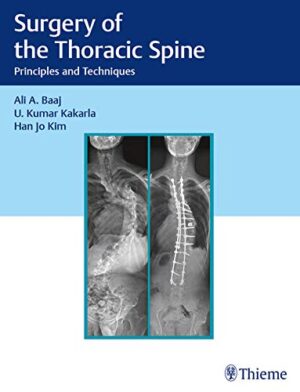 free-pdf-download-Surgery of the Thoracic Spine: Principles and Techniques