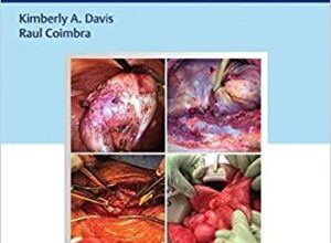 free-pdf-download-Surgical Decision Making in Acute Care Surgery