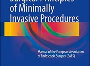 free-pdf-download-Surgical Principles of Minimally Invasive Procedures