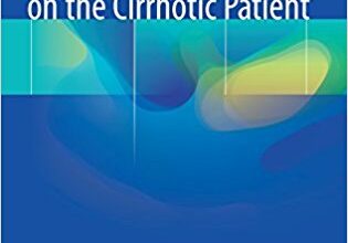 free-pdf-download-Surgical Procedures on the Cirrhotic Patient 1st ed. 2017 Edition