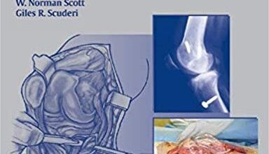 free-pdf-download-Surgical Techniques for the Knee