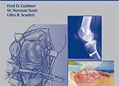 free-pdf-download-Surgical Techniques for the Knee