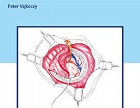 free-pdf-download-Surgical Techniques in Moyamoya Vasculopathy: Tricks of the Trade