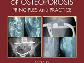 free-pdf-download-Surgical and Medical Treatment of Osteoporosis