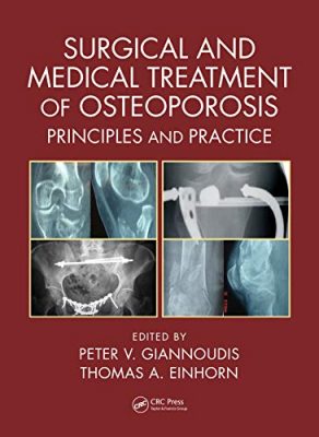 free-pdf-download-Surgical and Medical Treatment of Osteoporosis