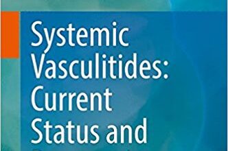 free-pdf-download-Systemic Vasculitides: Current Status and Perspectives 1st ed. 2016 Edition