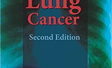 free-pdf-download-Textbook of Lung Cancer