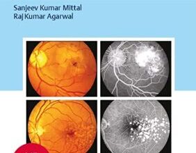 free-pdf-download-Textbook of Ophthalmology