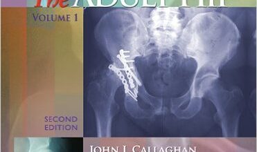 free-pdf-download-The Adult Hip (Adult Hip (Callaghan)(2 Vol.)) Second Edition